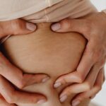 Best Stretch Mark Creams on Amazon (2026): Honest Reviews & Top Picks